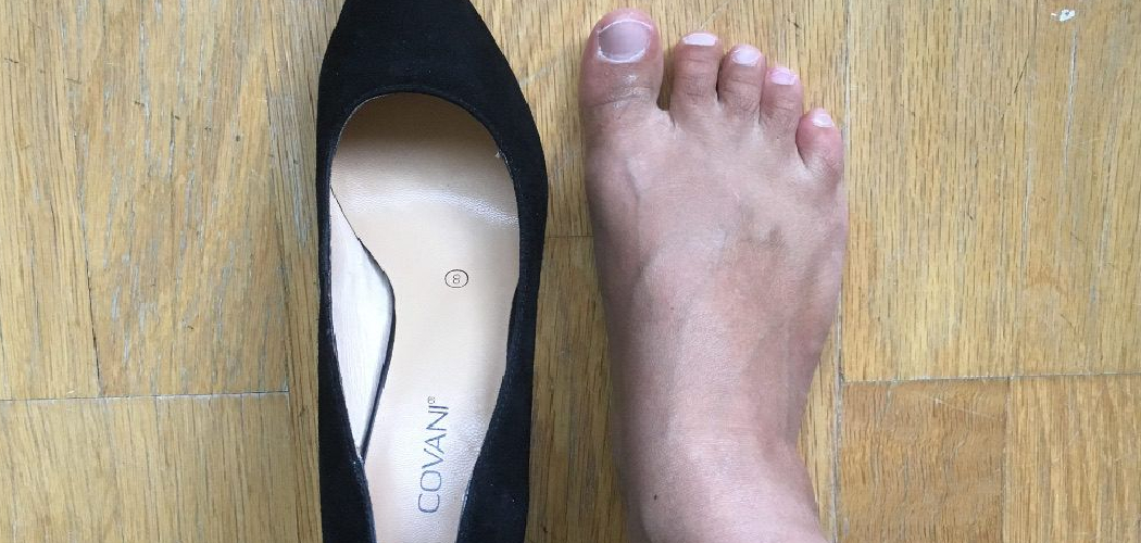 How to Stretch Shoes for Wide Feet